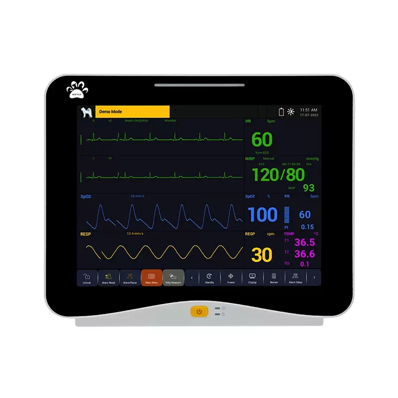 iM-12V EtCO2-Patientenmonitor mit Drucker