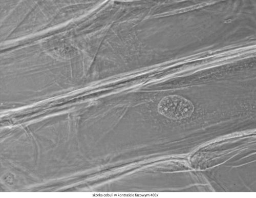 Delta Optical Genetic Pro Bino Mikroskop Delta-Optical-Genetic-Pro-Bino-11.jpg
