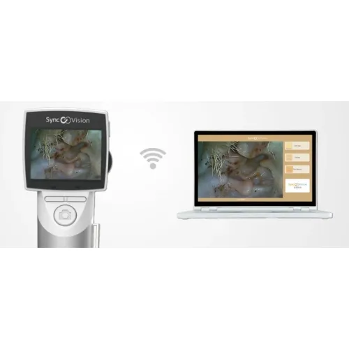 Veterinär-Videotoskop i01 Elite VET SyncVision videootoskop-weterynaryjny-i01-elite-syncvision (1).webp